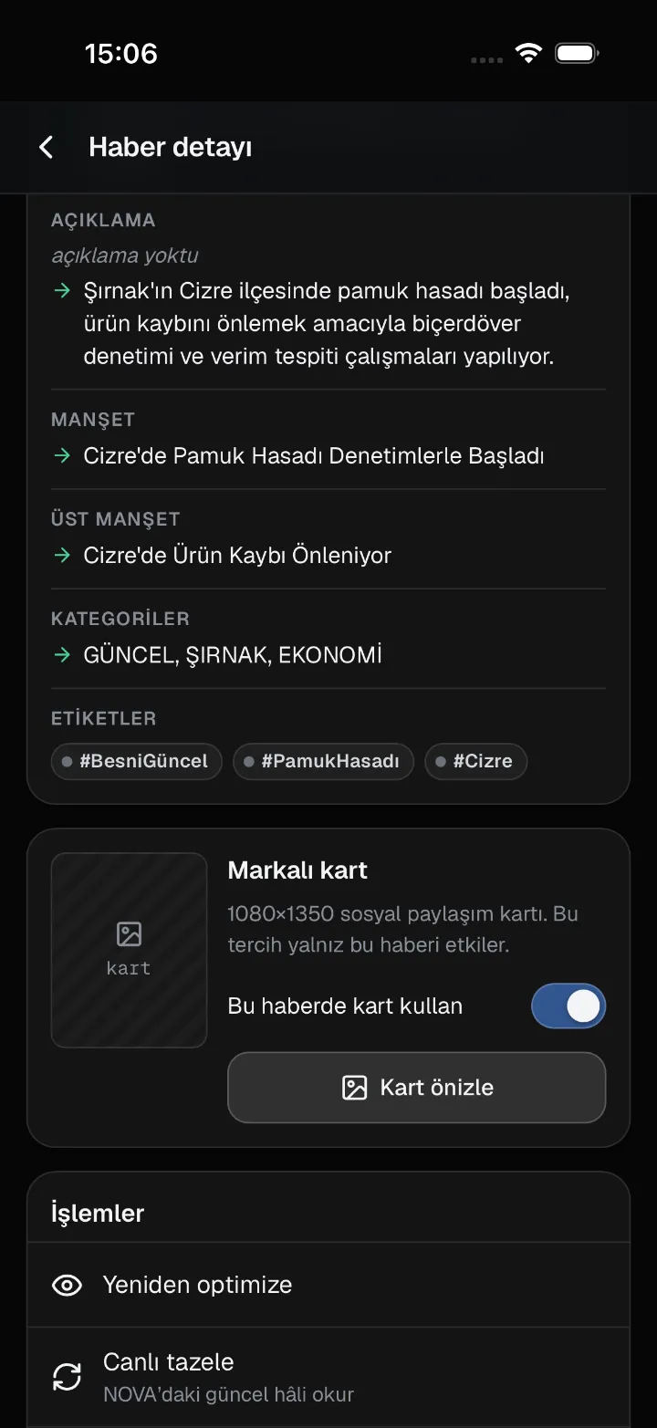 Haber detayı: değişen alanlar ve kart
